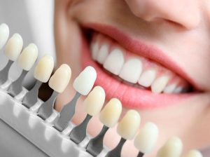 Riesgos de blanqueamiento dental